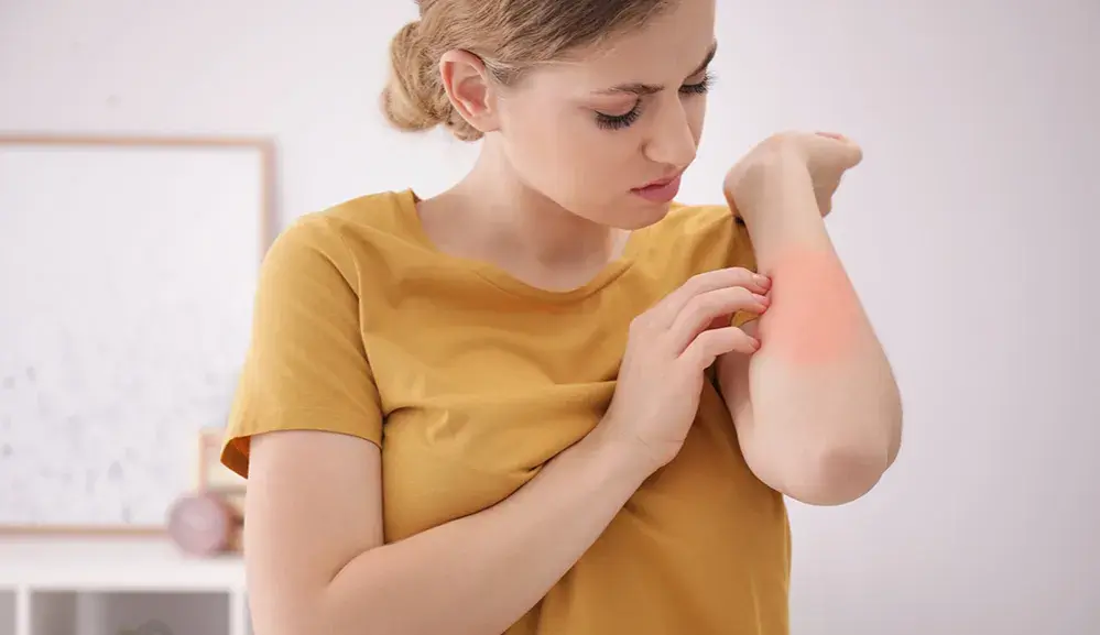 Alergia na roztocza: objawy skórne, AZS i jak sobie z nimi radzić
