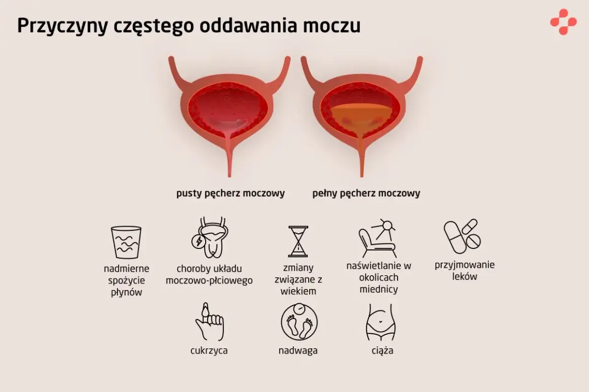 Ilustracja pokazuje przyczyny problemów z oddawaniem moczu u mężczyzn: nadmierne picie, choroby układu moczowo-płciowego, wiek, naświetlanie, leki, cukrzyca, nadwaga, ciąża.