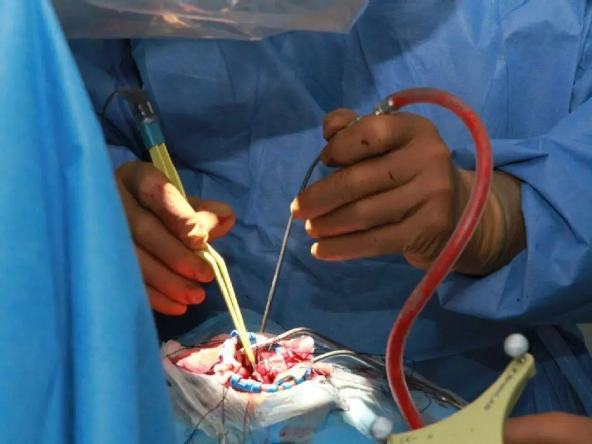 Chirurgen führen eine Hirntumor-OP durch. Hände mit Instrumenten arbeiten präzise am Gehirn.
