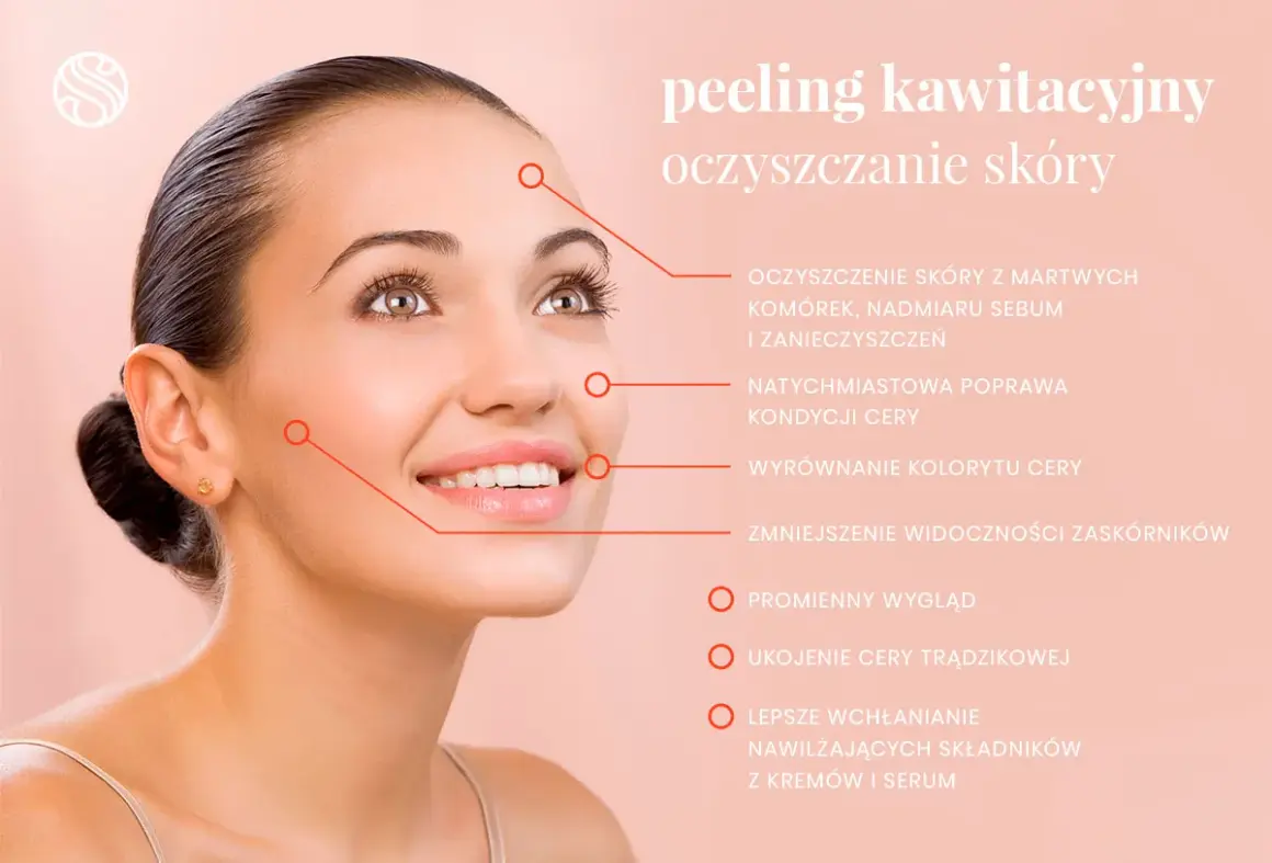 Uśmiechnięta kobieta z promienną cerą, której towarzyszy opis korzyści z peelingu kawitacyjnego, w tym głębokie oczyszczanie skóry.
