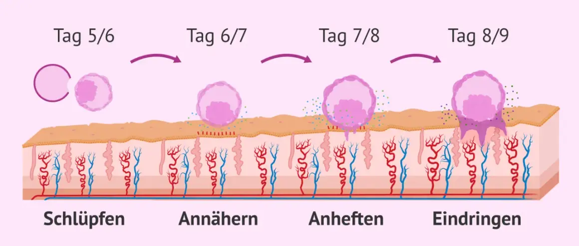 Was passiert nach dem Eisprung: Ein Embryo schlüpft, nähert sich, heftet sich an und dringt in die Gebärmutterschleimhaut ein.