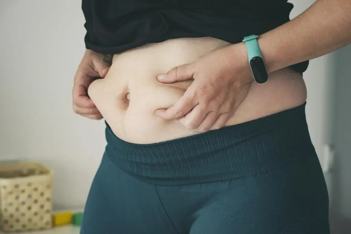Osoba ściska fałd tłuszczu na brzuchu, zastanawiając się, ile trzeba chodzić, żeby spalić 500 kcal.