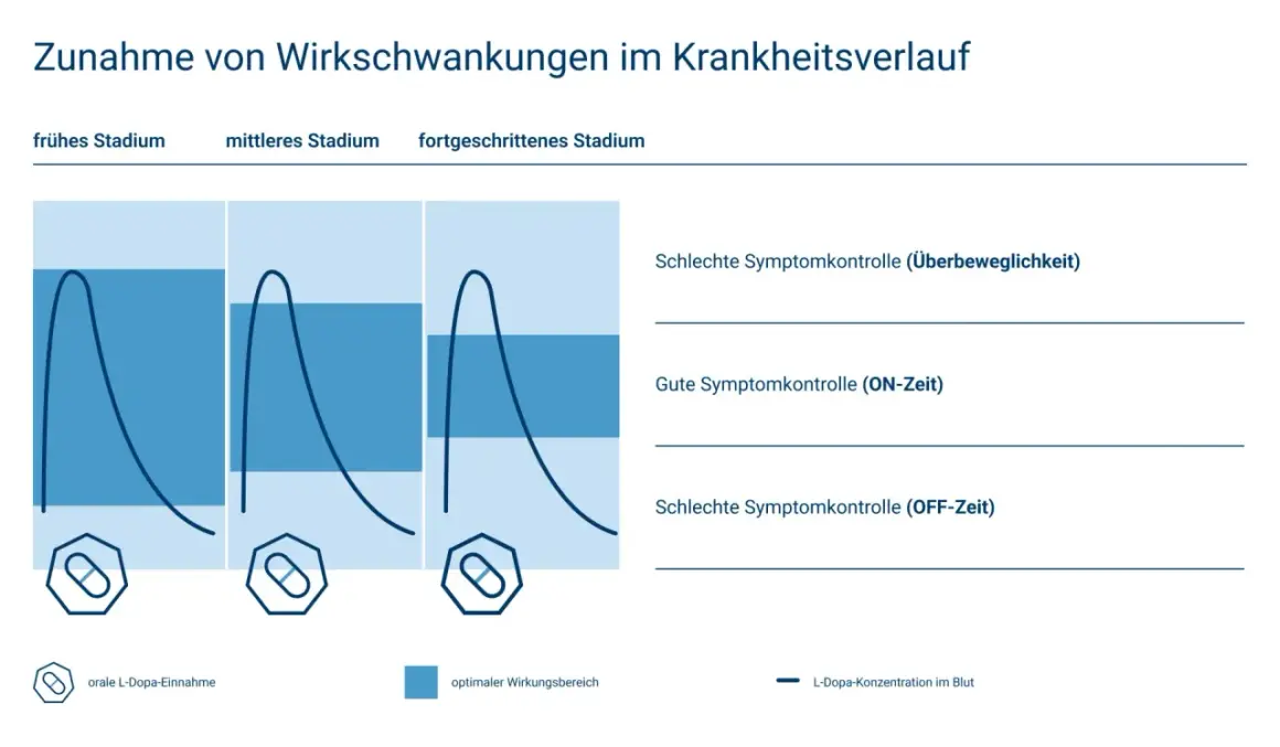 Grafik zeigt L-Dopa-Konzentration im Blut über die Zeit bei Parkinson. Mit zunehmendem Krankheitsverlauf (10 Jahre) werden die Schwankungen größer.