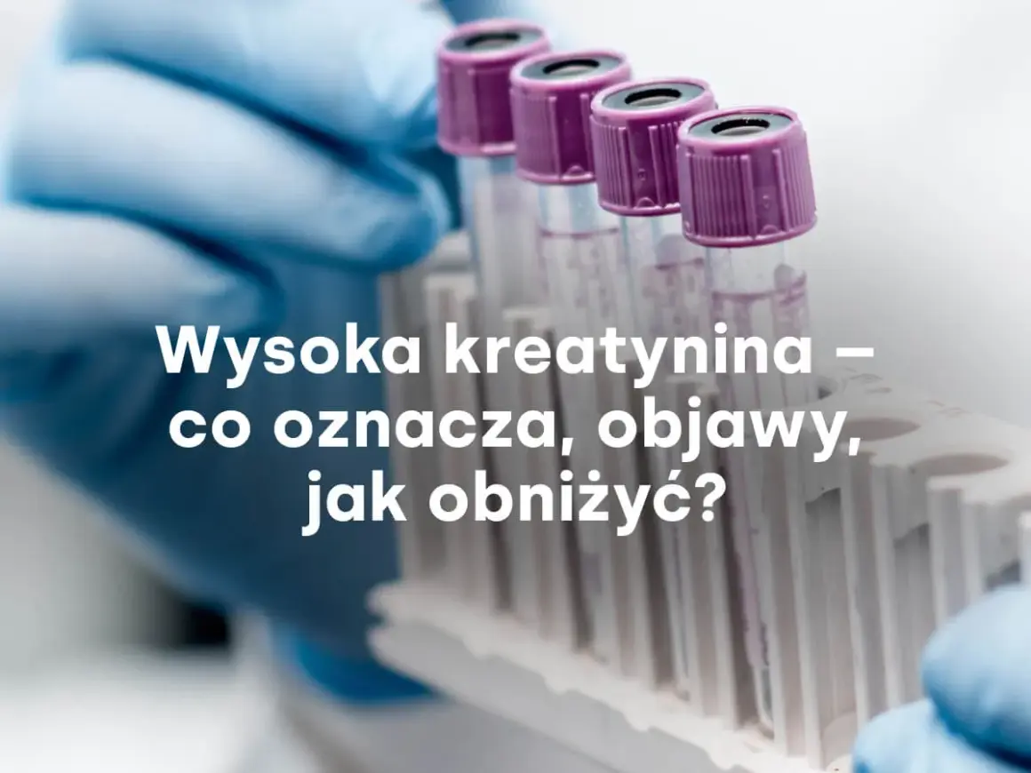 Rękawiczka laboratoryjna trzyma probówki. Tekst: Wysoka kreatynina – co oznacza, objawy, jak obniżyć?