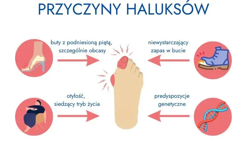 Czy haluksy są dziedziczne? Geny, buty i profilaktyka