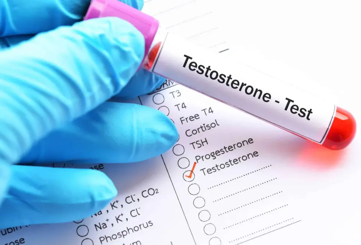 Rękawiczka w niebieskiej rękawiczce trzyma probówkę z krwią do badania. Na formularzu zaznaczono "Testosterone", co jest kluczowe, jak sprawdzić poziom testosteronu.
