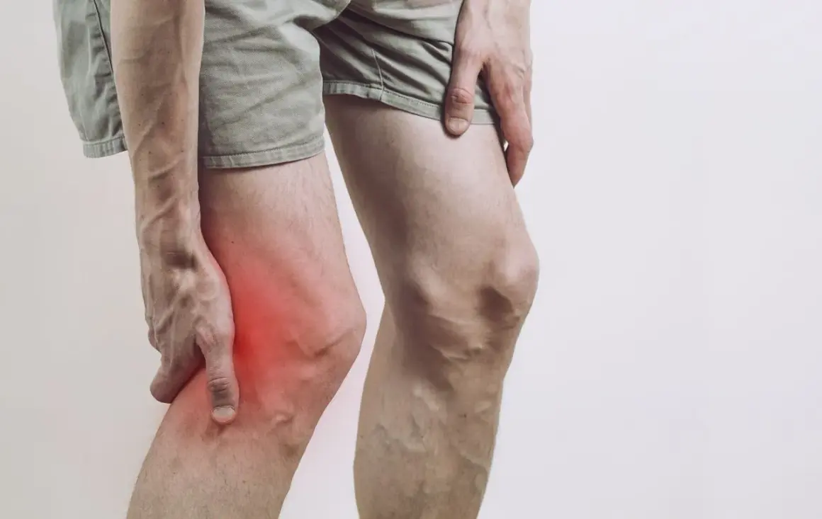 Ból w przedniej części kolana, gdzie widoczny jest zaczerwieniony guz.