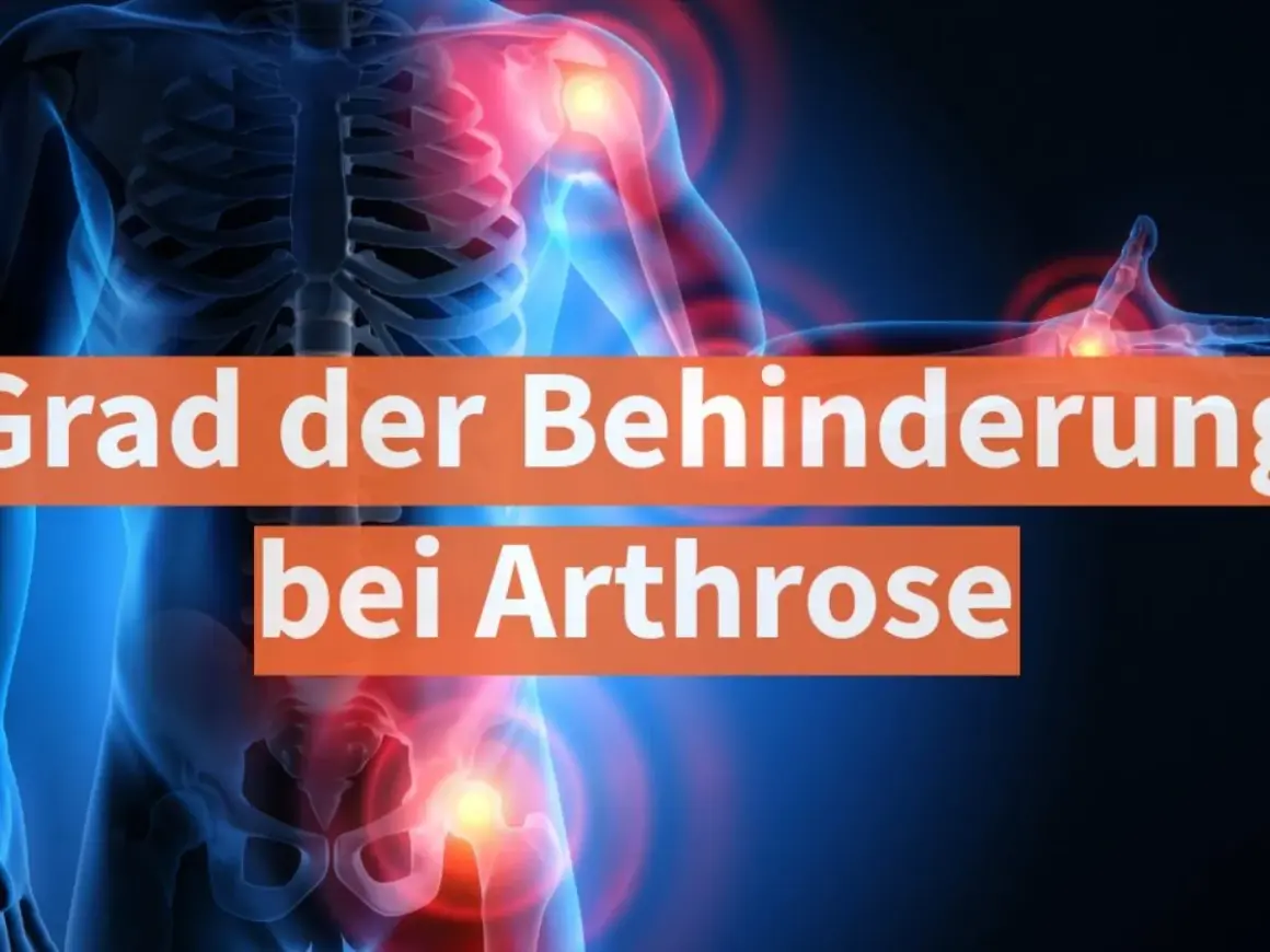 Grafik zeigt menschlichen Körper mit schmerzenden Gelenken. Text: "Grad der Behinderung bei Arthrose".