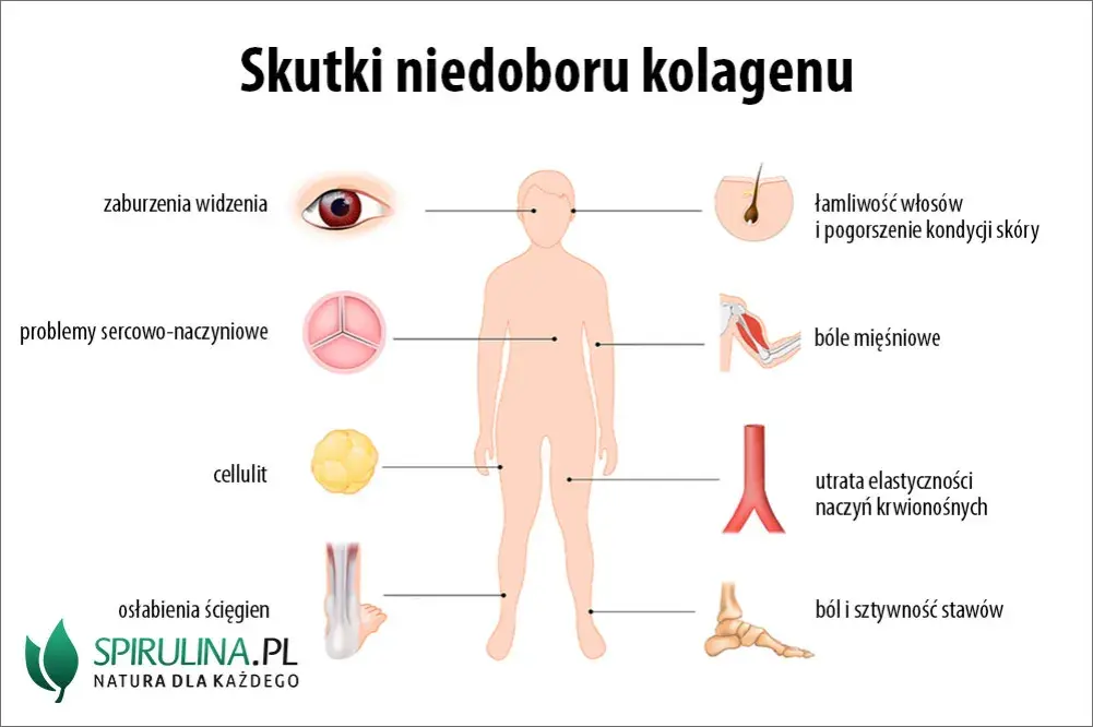 Objawy niedoboru kolagenu: Rozpoznaj i skutecznie uzupełnij!