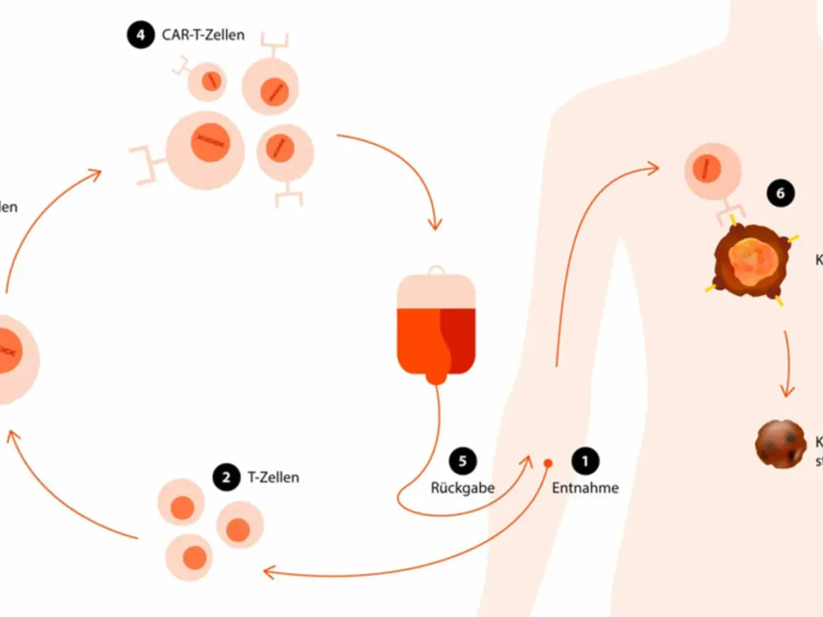 Schema zur Immuntherapie: T-Zellen werden entnommen, modifiziert (CAR-T-Zellen) und zurückgegeben, um Krebszellen zu bekämpfen. So schnell wirkt Immuntherapie.