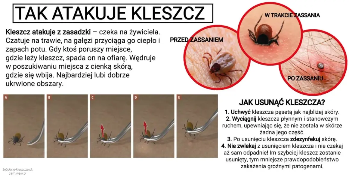 Zdjęcie przedstawia kleszcza **ixodes ricinus** przed, w trakcie i po zassaniu, a także instrukcję usuwania go.