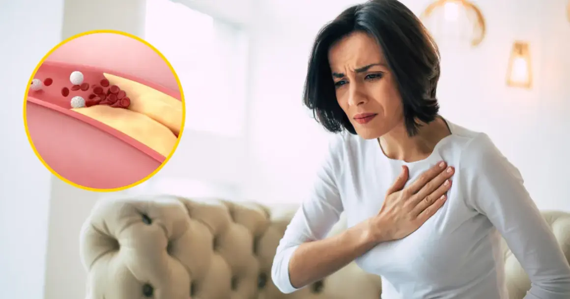 Kobieta trzymająca się za serce obok schematu zatkanego cholesterolem naczynia krwionośnego.