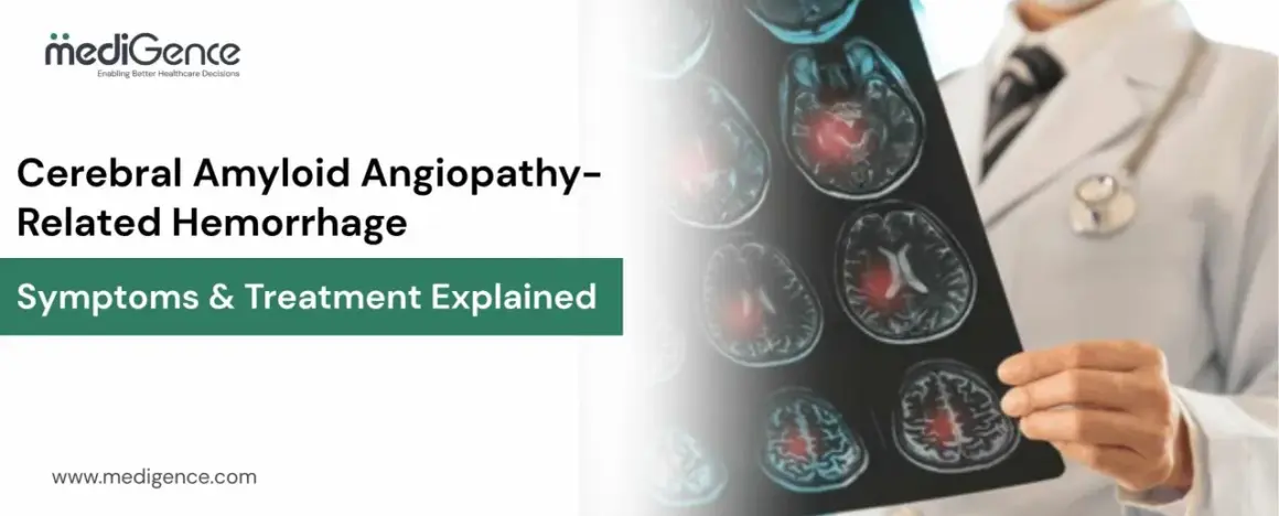 Arzt hält MRT-Aufnahmen, die Hirnblutungen bei CAA (Cerebral Amyloid Angiopathy) zeigen. Informationen zu Symptomen und Behandlung.