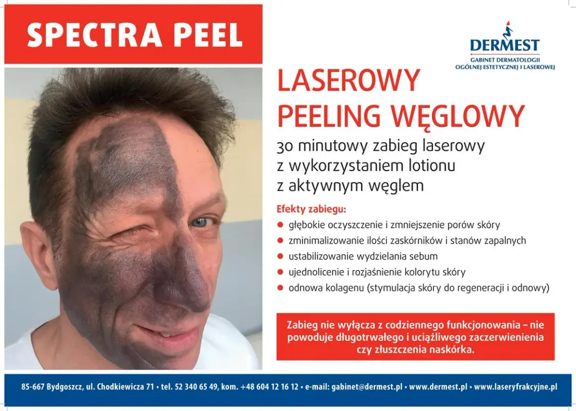 Mężczyzna z połową twarzy pokrytą czarną maską węglową po zabiegu Spectra Peel. Laserowy peeling węglowy nie powoduje skutków ubocznych jak zaczerwienienie czy złuszczanie.
