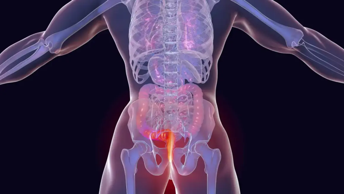 Anatomische Darstellung des menschlichen Körpers mit Hervorhebung des Enddarms. Mögliche analkrebs symptome werden hier visuell dargestellt.