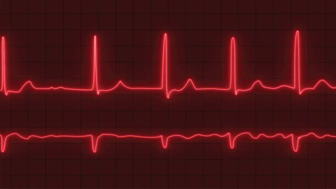 Dwa zapisy EKG na czerwonym tle. Górny zapis pokazuje szybkie, regularne skoki, sugerujące tachykardię zatokową. Dolny zapis jest wolniejszy.