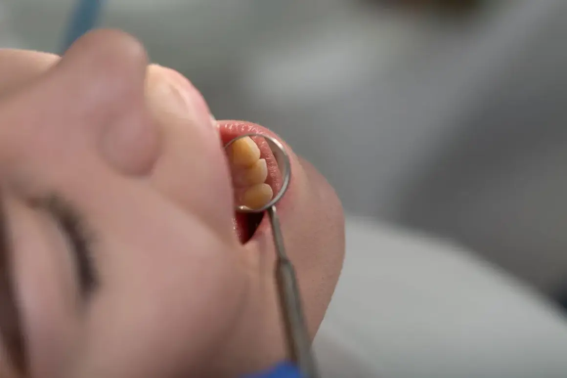 Usta pacjenta z widocznym 9 zębem, oglądanym przez dentystyczne lusterko.