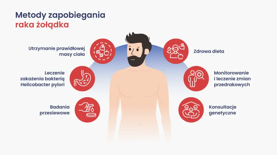 Metody zapobiegania raka żołądka: zdrowa dieta, kontrola masy ciała, leczenie H. pylori, badania przesiewowe, monitorowanie zmian, konsultacje genetyczne.