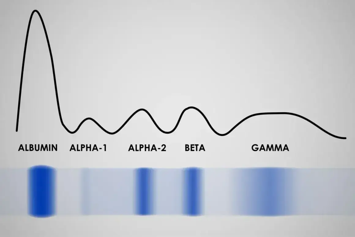 Wykres proteinogramu z frakcjami: albumina, alfa-1, alfa-2, beta, gamma. Widoczne pasma elektroforetyczne.