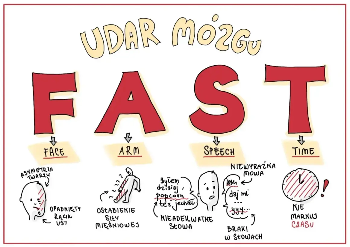 FAST - objawy udaru mózgu: opadnięta twarz, osłabienie ręki, niewyraźna mowa, brak czasu.