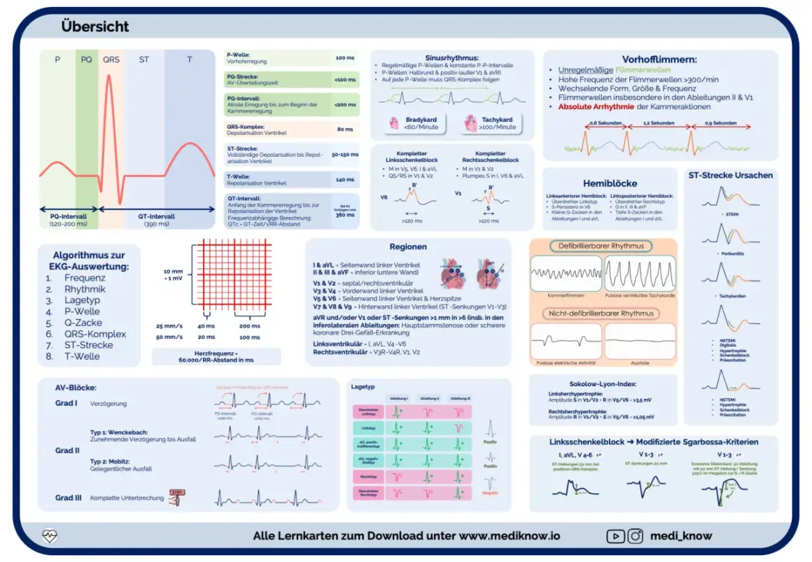 EKG-Schema erklärt Herzinfarkt-Anzeichen: ST-Strecken-Veränderungen wie bei STEMI, Perikarditis oder Tachykardien.