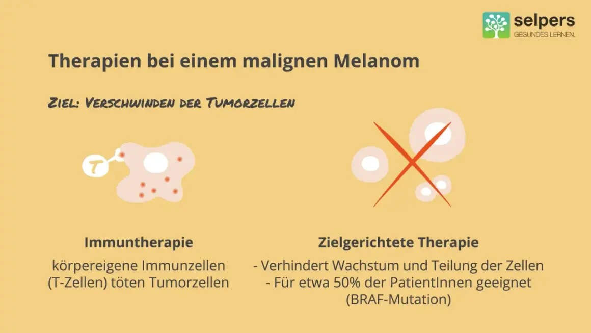 Illustrationen zeigen zwei Therapien gegen Melanom: Immuntherapie mit T-Zellen, die Tumorzellen angreifen, und zielgerichtete Therapie, die Zellwachstum stoppt.