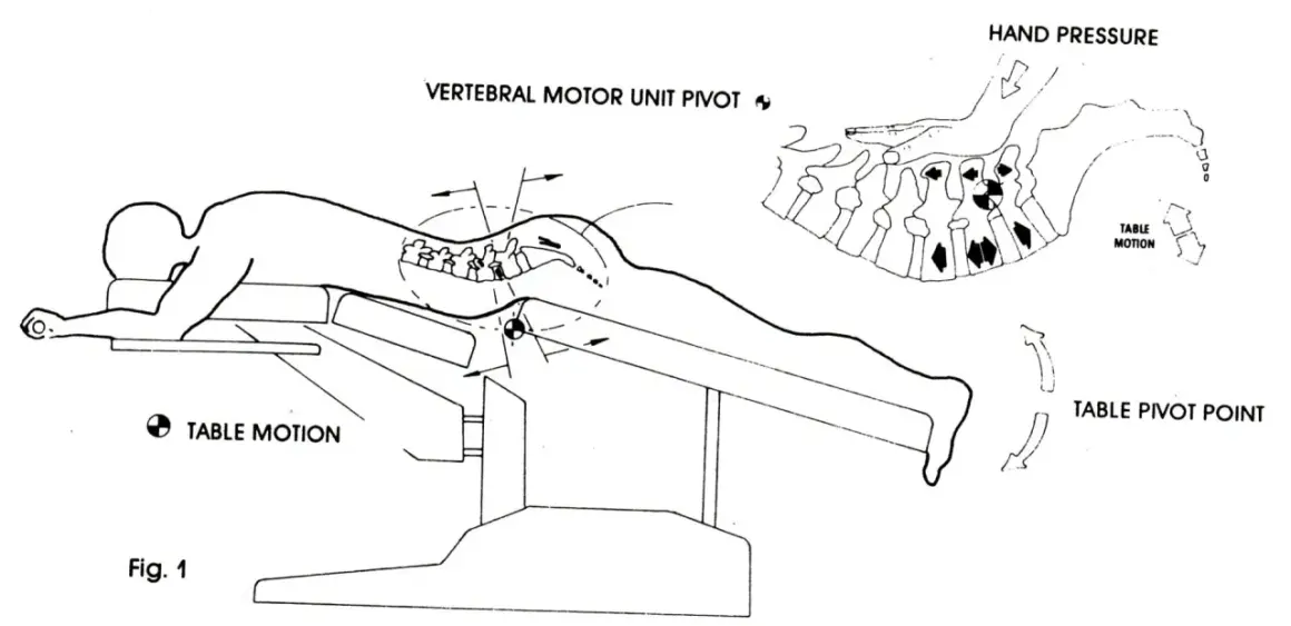 Ilustracja pokazuje technikę terapii manualnej kręgosłupa, która może pomóc w odpowiedzi na pytanie: czy wypuklina może się cofnąć.