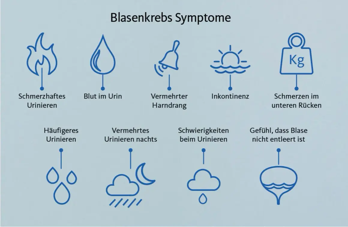 Grafik zeigt Symptome von Blasenkrebs: schmerzhaftes Urinieren, Blut im Urin, Harndrang, Inkontinenz, Rückenschmerzen, häufiges Urinieren, nächtliches Urinieren, Schwierigkeiten beim Urinieren, Gefühl der unvollständigen Blasenentleerung. Ein blasen tu...