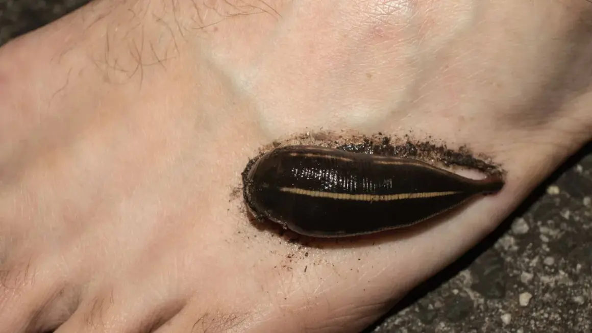 Une sangsue de rivière s'est accrochée au pied, une rencontre désagréable lors d'une baignade.