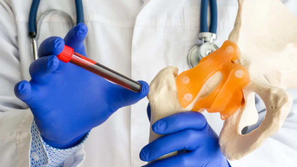 Lekarz w niebieskich rękawiczkach trzyma probówkę z krwią obok modelu miednicy, symbolizując diagnostykę raka szpiku kostnego.