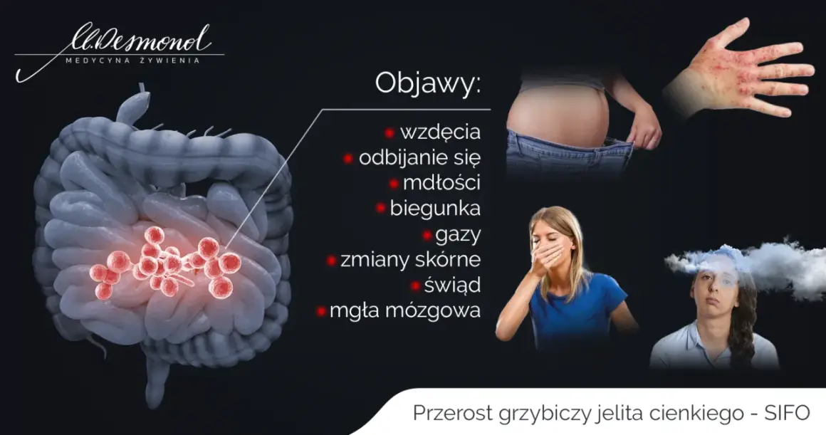 Przerost grzybiczy jelita cienkiego objawy: wzdęcia, mdłości, biegunka, gazy, zmiany skórne, mgła mózgowa.