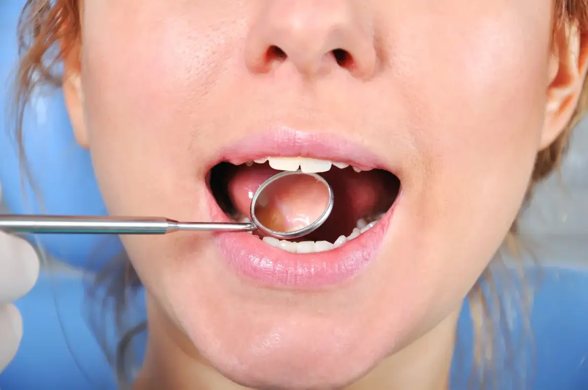 Usta kobiety z lusterkiem dentystycznym, badanie złamanego zęba przy dziąśle. Cena zabiegu może być różna.