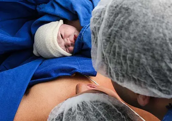 Czy cesarka to operacja? Poznaj prawdę o cesarskim cięciu