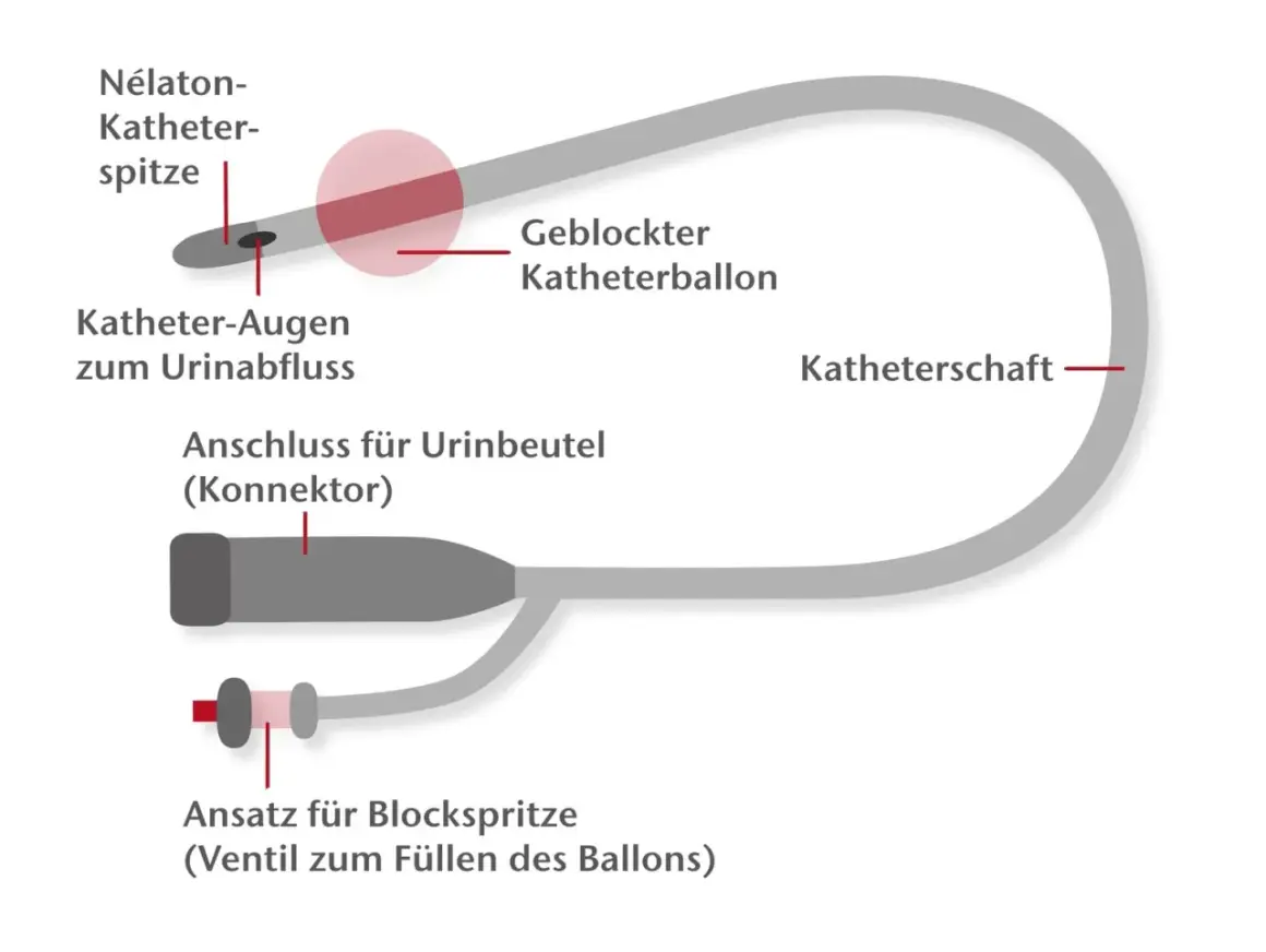 Schema eines Katheters für den Mann: Nélaton-Spitze, Ballon, Anschluss für Urinbeutel und Ansatz für Blockspritze.