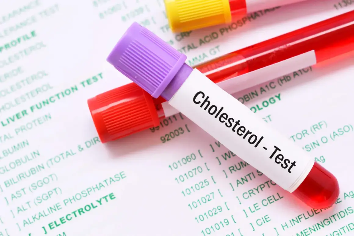 Probówki z krwią na tle dokumentu z badaniami. Jedna probówka ma etykietę "Cholesterol - Test". To pokazuje, lipidogram co to jest.