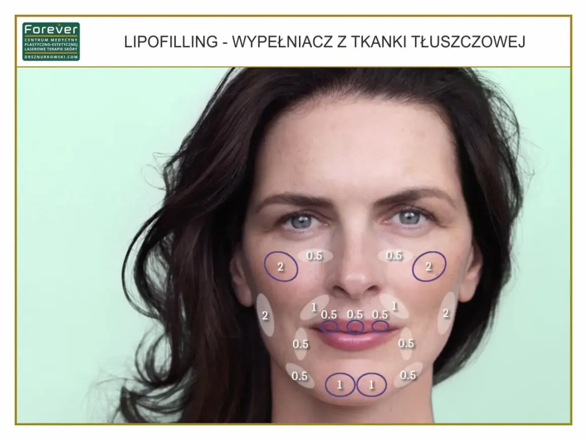 Liposukcja kawitacyjna: Ile zabiegów? Konkretne liczby i efekty
