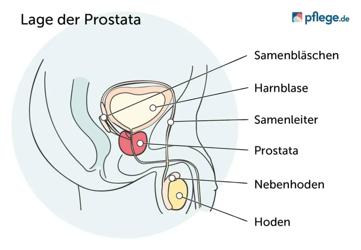Anatomische Darstellung der Prostata. Bei fortgeschrittenem Prostatakrebs mit Streuung kann die Lebenserwartung variieren.