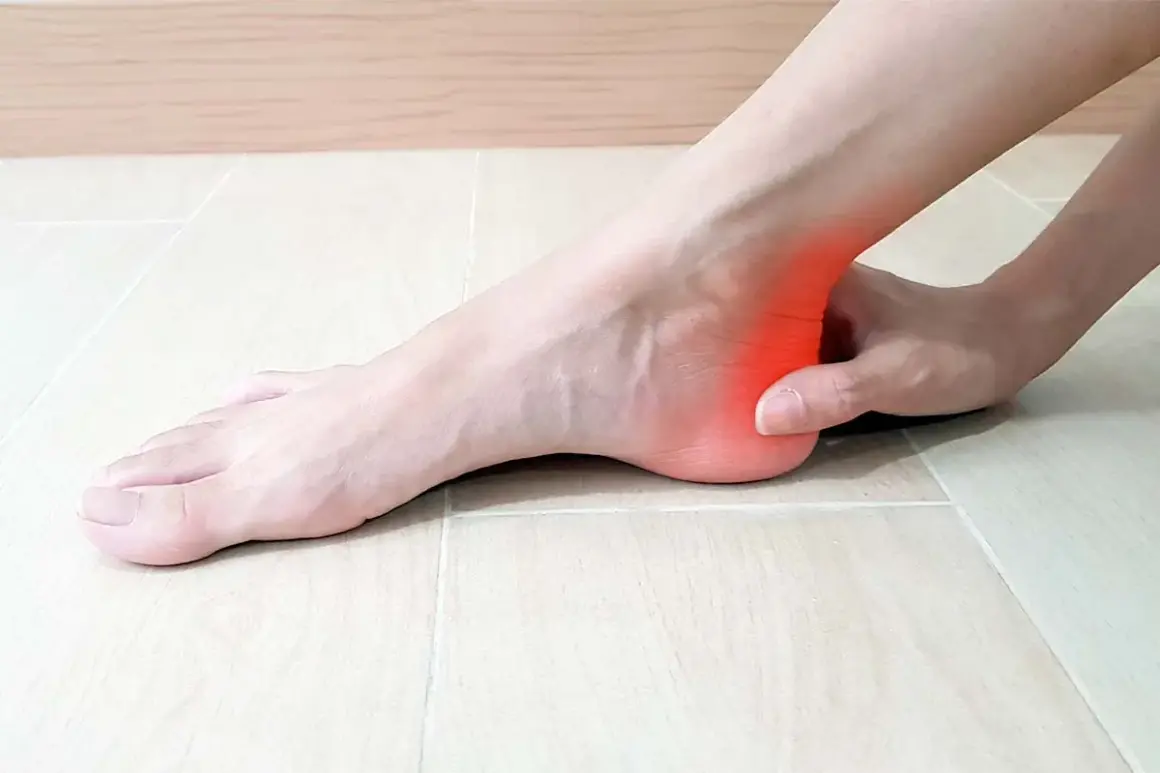Dolore al tallone, un'area rossa indica la tendinite del dorso del piede.