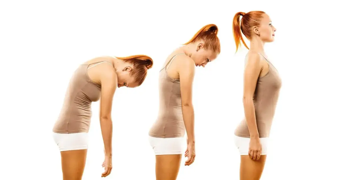 Tre pose a confronto: una donna con postura scorretta in piedi, poi leggermente meglio, e infine con postura corretta in piedi.
