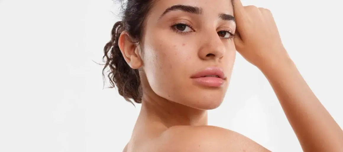 Une jeune femme au visage naturel, avec quelques imperfections, pose pour montrer comment avoir un beau visage.
