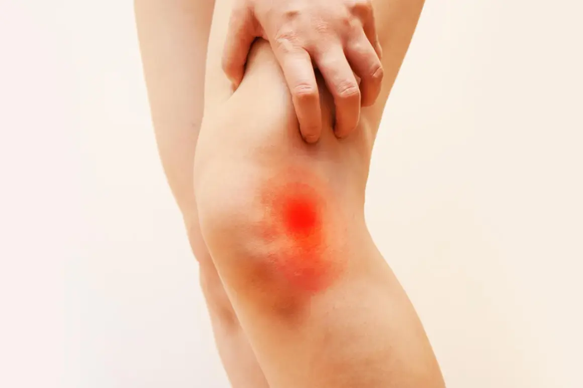 Mano che si gratta il ginocchio con un'area rossa e infiammata, sintomo di bruciore al ginocchio.