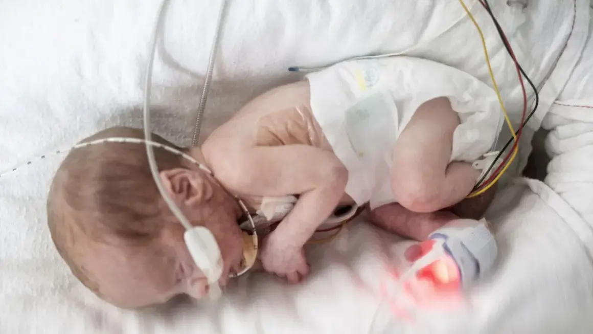 Ein winziges Baby, geboren in der 18. SSW, liegt in einem Inkubator, verbunden mit medizinischen Geräten.
