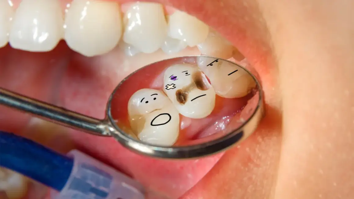 Zęby z namalowanymi buźkami w odbiciu lusterka dentystycznego. Jeden ząb ma próchnicę i wygląda na chorego. Czy zęby się regenerują?
