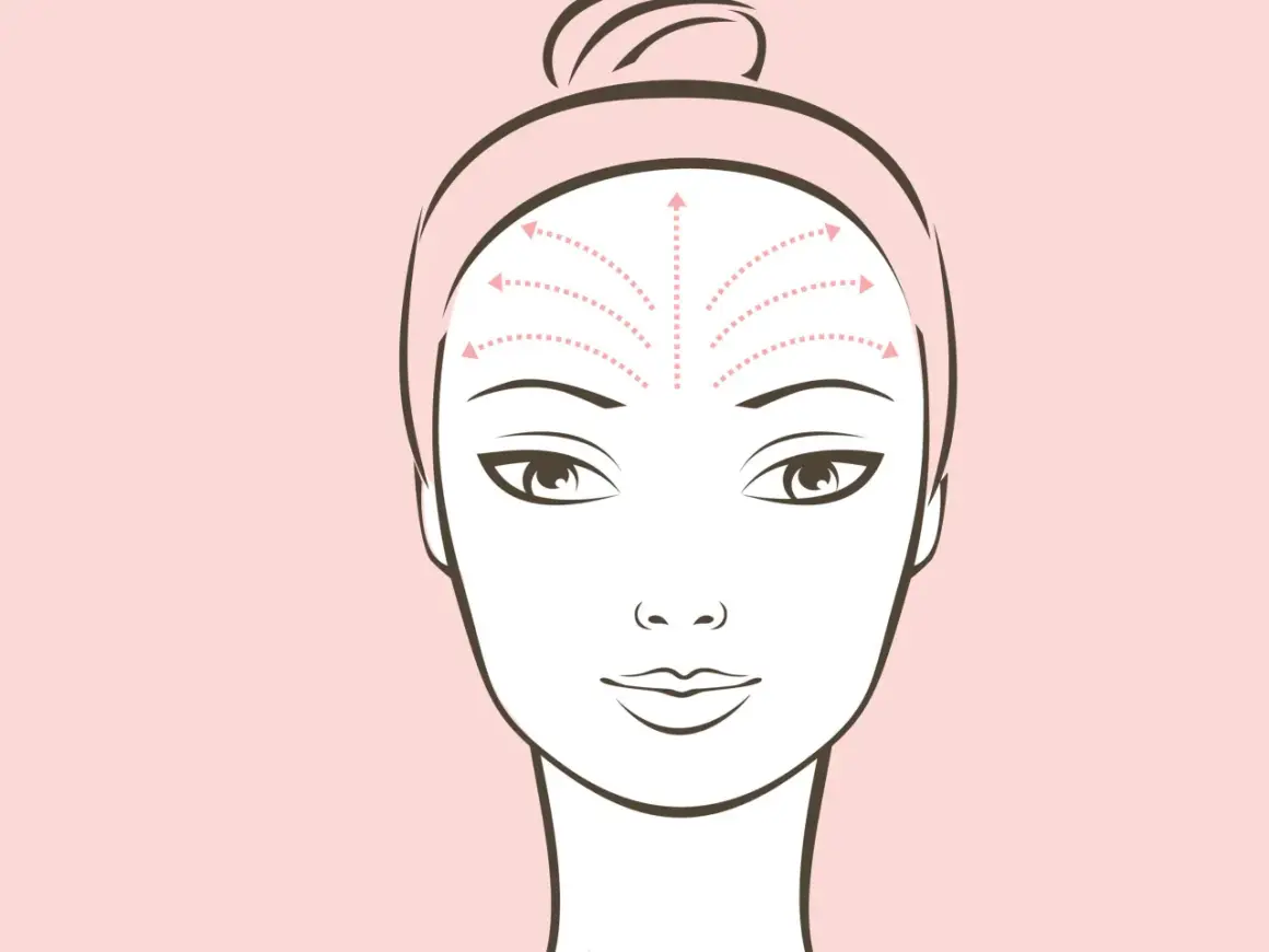 Illustrazione di un viso con frecce che indicano movimenti verso l'alto sulla fronte, suggerendo l'effetto lifting significato.
