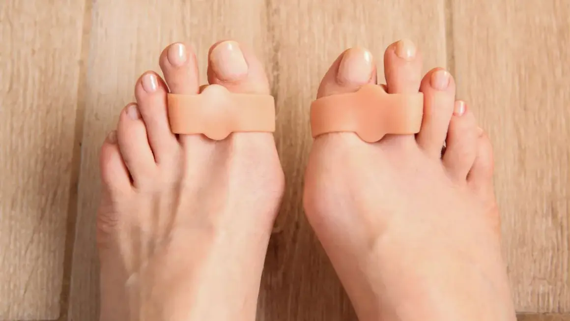 Separatori per dita dei piedi per correggere l'alluce valgo inizio.