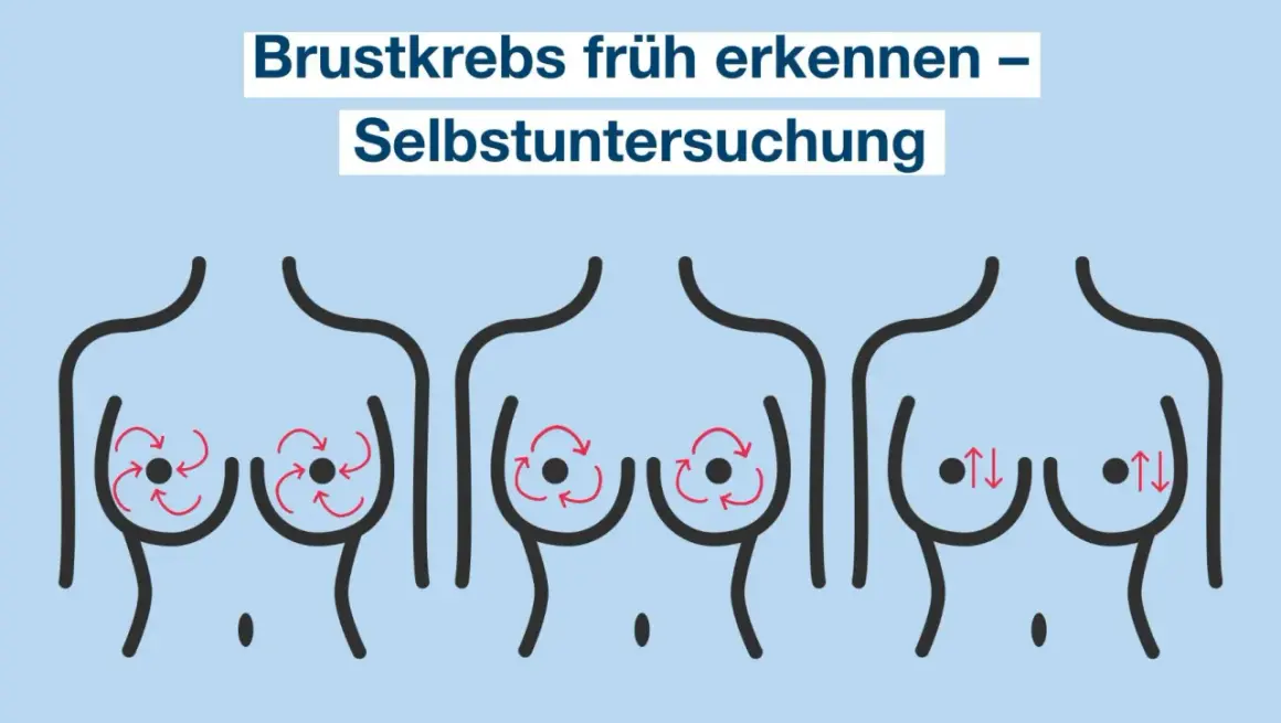 Brustkrebs früh erkennen durch Selbstuntersuchung. Illustration zeigt drei Brüste mit roten Pfeilen, die verschiedene Abtasttechniken darstellen.