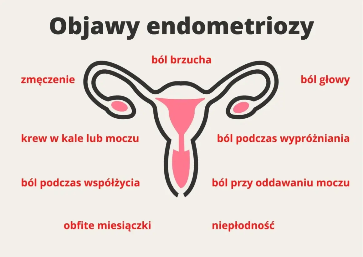 Objawy endometriozy: ból brzucha, zmęczenie, krew w kale/moczu, ból głowy, ból podczas wypróżniania, ból przy oddawaniu moczu, ból podczas współżycia, obfite miesiączki, niepłodność.