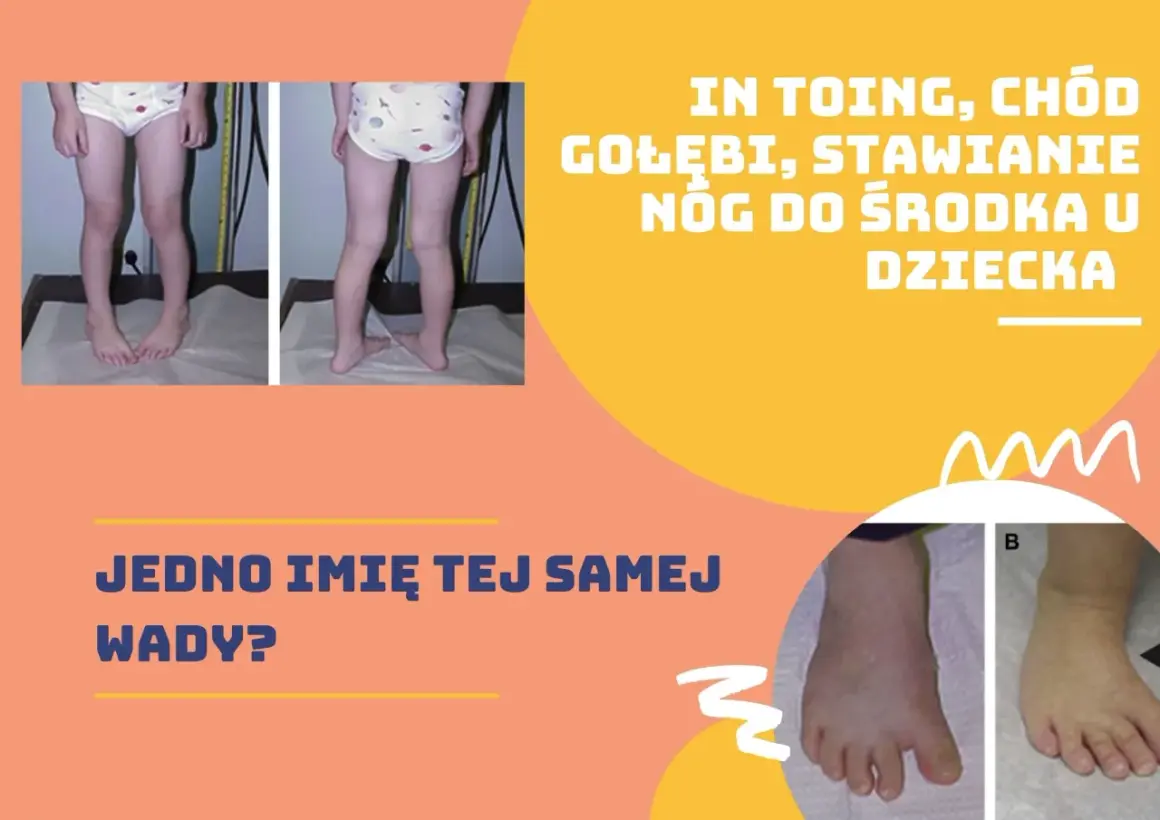 Dziecko z nogami skierowanymi do środka, co może być określane jako kaczy chód.