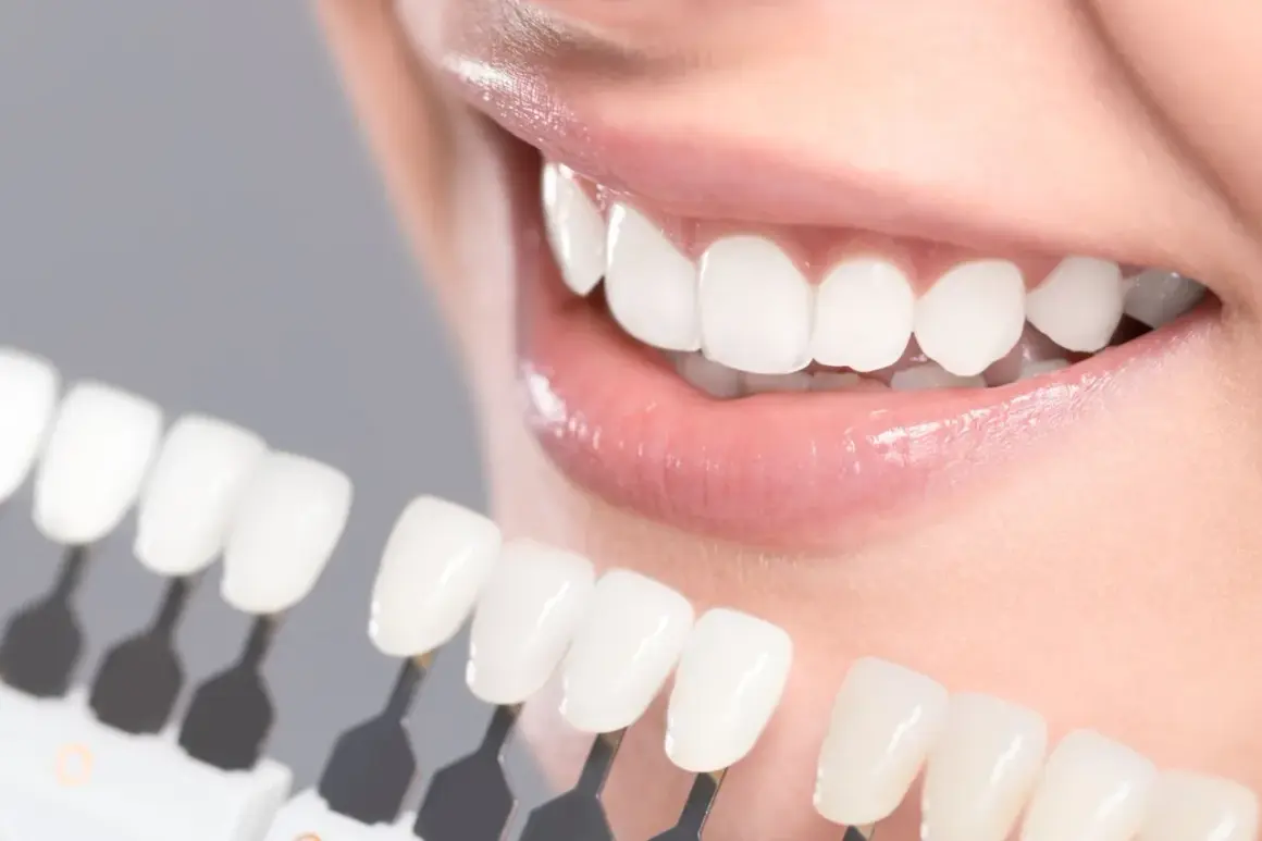 Wybielanie zębów sodą: Czy warto ryzykować? Opinia dentystów