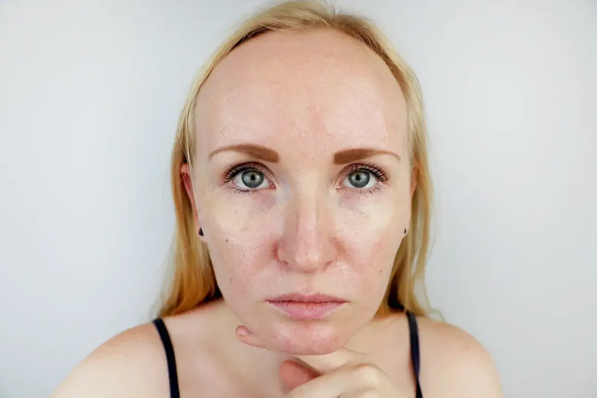 Blondynka z niejednolitą cerą, zastanawia się, co zrobić, żeby twarz się nie świeciła po nałożeniu podkładu.